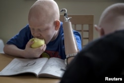 FILE - Mwigulu Matonage Magesa of Tanzania does homework in the Staten Island borough of New York, Sept. 21, 2015. The 12-year-old was outfitted for a prosthetic after his arm was brutally amputated by attackers in the East African country.