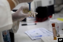FILE - A blood samples from pregnant women are analyzed for the presence of the Zika virus, at Guatemalan Social Security maternity hospital in Guatemala City, Feb. 2, 2016.
