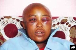 Millicent Gaika, recovering from a vicious assault in Cape Town, South Africa, last year
