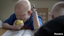 Mwigulu Matonage Magesa, enfant albinos de 12 ans, victime d'amputation en Tanzanie. Il est aujourd'hui en sécurité à New York. 21 septembre 2015, REUTERS / Carlo Allegri