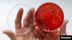 Seorang ilmuwan meneliti bakteri staphylococcus aureus yang kebal obat di sebuah laboratorium di Berlin, Jerman (foto: ilustrasi). 