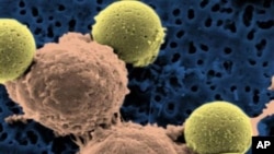 This microscopy image provided by Dr. Carl June shows immune system T-cells (C) binding to beads that cause the cells to divide, then are later removed to leave pure T-cells, which are then ready for infusion to leukemia patients, August 2011.