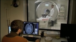 Israeli Study: Male, Female Brains More Similar Than Thought
