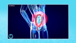 Carnet de Santé: Les hémorroïdes