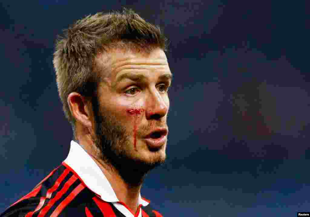 David Beckham pasca cedera dalam pertandingan seri A Italia pada 2010 melawan Chievo, saat ia bergabung dengan AC Milan. (Reuters/Alessandro Garofalo)