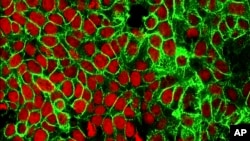 ნაწლავის კიბოს მიკროსკოპული გამოსახულება. აშშ-ის კიბოს ეროვნული ინსტიტუტი. 