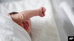 FILE - In this July 26, 2016 file photo, a newborn baby with microcephaly rests at a maternity ward of the University Hospital in Tegucigalpa, Honduras. (AP Photo/Fernando Antonio, File)