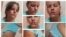 Photographs of Mabel Páez, a Cuban journalist who says she was attacked by masked men she believes were working for the government. (Mabel Páez via ICLP)