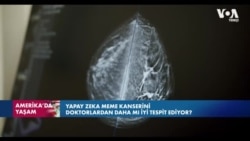 Yapay zeka meme kanserini doktorlardan daha mı iyi tespit ediyor?