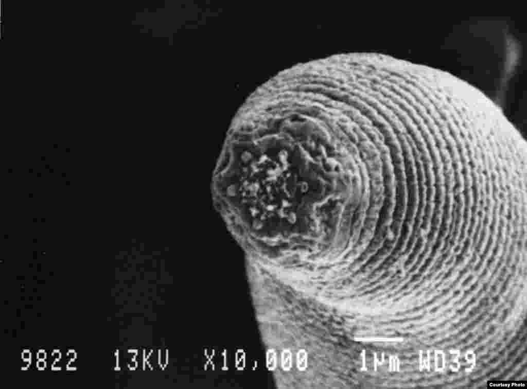 Halicephalobus mephisto. Common Name: Devil&rsquo;s Worm. These tiny nematodes discovered in a South African gold mine are the deepest-living multicellular organisms on the planet. (Photo: G. Borgonie, Ghent University, Belgium)