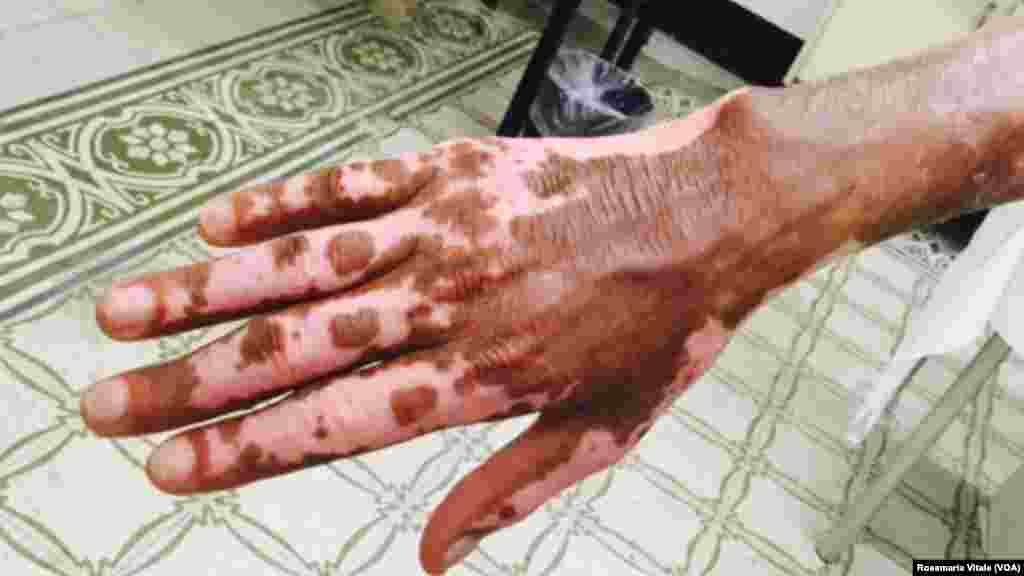 አብ ጉዕዞ ሊብያ-አውሮጳ ብነጋዶ ደቂ-ሰባት ኣእዳው ዝተቃጸለ ስእሊ እቲ ግዳይ አብ ኢጣልያ -ሚላን ስደተኛታት ካብ ዝሕክም ኢጣልያዊ ዝተረኽበ&#39;ዩ