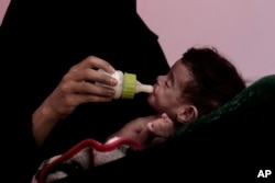 Ahmed Rashid Mokbel, a severely malnourished 7-month-old Yemeni boy, is given formula by his mother at the Al-Sadaqa Hospital in Aden, Yemen, Feb. 13, 2018. The boy weighed only 3.3 kg (7 pounds).