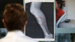 Quiz - US Medical Schools Increase LGBTQ Students, Doctor Training