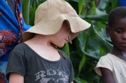 This girl survived an abduction in April 2019 the night when her albino brother Goodson was abducted in Dedza district in central Malawi. (Lameck Masina/VOA)