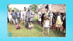 La circoncision masculine, pourquoi et à quel âge?