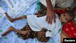 FILE - A father places his hand on his 7-year-old son, who is suffering from typhoid, in Pakistan's northwest Khyber Pakhtunkhwa province, Sept. 15, 2010.