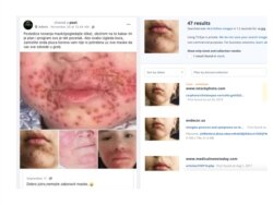 Verification of a Facebook post from a group Anon Balkanika about masks