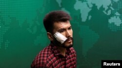 លោក Neamat Naghdi អាយុ ២៨ ឆ្នាំ ជា​អ្នកយកព័ត៌មាន​សម្រាប់​កាសែត Etilaat Roz ដែល​ត្រូវបាន​ក្រុមតាលីបង់​វាយដំ​ពេល​កំពុង​ជាប់ឃុំ​នៅ​ការិយាល័យ​កាសែត​ក្នុង​ទីក្រុង​កាប៊ុល ប្រទេស​អាហ្វហ្គានីស្ថាន កាលពី​ថ្ងៃទី៩ ខែកញ្ញា ឆ្នាំ២០២១។