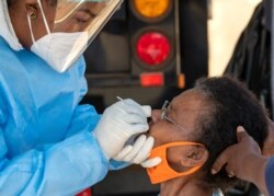 An woman reacts as a heatlh worker collects a sample for coronavirus testing during the screening and testing campaign aimed to combat the spread of COVID-19, in Eldorado Park outside of Johannesburg, South Africa, Aug. 3, 2020.