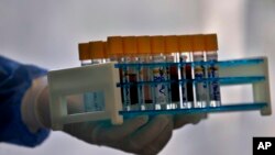 Arhiva - Uzorci koji se testiraju na prisustvo koronavirusa (AP Photo/Anjum Naveed)