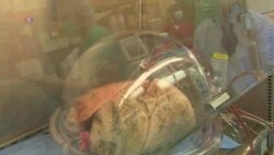 US Researchers Hope to Increase Availability of Donor Lungs