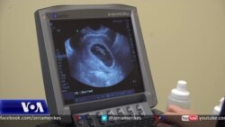 Beteja pro e kundër të drejtës së abortit