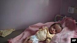 A malnourished boy lies in a bed waiting to receive treatment at a feeding center at Al-Sabeen hospital in Sanaa, Yemen, June 27, 2020. 