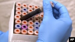 Tes yang dilakukan mengukur sembilan karakteristik, atau penanda, dalam darah.