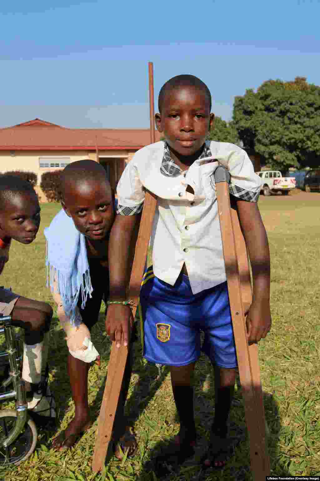Young boys recovering from surgery.