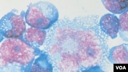 Virus HIV ini dapat ditekan tingkat penularannya melalui pengobatan dini dengan obat antiretroviral.