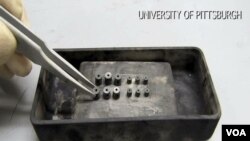 Para ilmuwan gunakan materi biodegradable untuk sembuhkan tulang patah