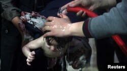 지난 8일 시리아 수도 다마스쿠스 인근 반군 장악지역인 두마에서 화학 공격을 받은 아이가 병원에서 치료를 받고 있다.