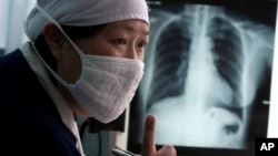 سالانه ۱۲ هزار نفر در اثر ابتلا به توبرکلوز در افغانستان می میرد