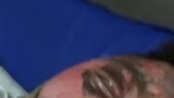 Tibetan Schoolboy Who Set Himself Alight Offers Final Statement