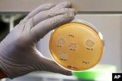 Yale University researcher Benjamin Chan, who studies viruses that attack bacteria, holds a petri dish containing Pseudomonas aeruginosa lung samples grown from patient Ella Balasa, at Osborne Memorial Laboratories, in New Haven, Conn., Jan. 17, 2019.