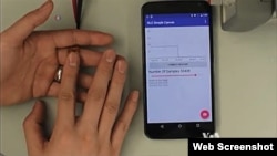 Worn like a piece of jewelry on your finger, a flexible ring embedded with a wireless electrocardiogram sensor that can diagnose heart irregularities, as well as other conditions.