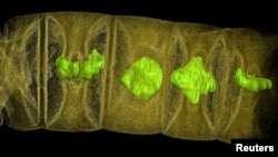 An X-ray tomographic picture of fossil thread-like red algae, tinted to show detail, unearthed in central India may represent the oldest-known plants on Earth, dating from 1.6 billion years ago, according to research published in the journal PLOS Biology. (Courtesy: Stefan Bengtson)