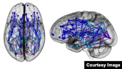 მამაკაცის თავის ტვინი
