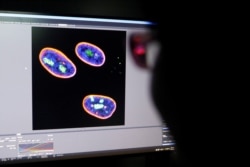 A researcher observes image on a screen showing the nucleus of human stem cells after KAT7 intervention, in the Aging and Regeneration lab at the Institute for Stem Cell and Regeneration of the Chinese Academy of Sciences (CAS) in Beijing, China.