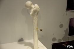 香港六四纪念馆展出从六四学生活动人士张健腿部取出的子弹 （美国之音记者申华拍摄）