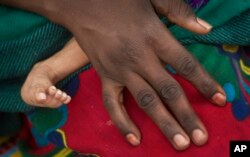 FILE - Stunted growth is a result of malnutrition in Chad's Sahel (above) and all of Central Africa. But 40 percent of those stunted children are in Cameroon.