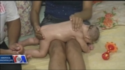 Zikaga qarshi kurashda chivinlar nishonda