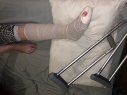 Khrystyna Shevchenko was injured covering looting in Santa Monica, California, on May 31, 2020. (VOA/Khrystyna Shevchenko)