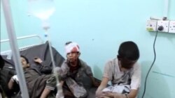 جنگ یمن چهار ساله شد - کودکان آسیب پذیرترین اند