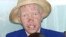 Liberia Opens Center For Albinos