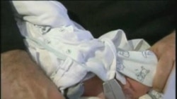 Obrezivanje muskaraca: zdravstvene koristi su vece od rizika