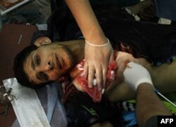 Qaddafiy kuchlari muxolifatni havodan urdi, mamlakat fuqaro urushiga tortilmoqda