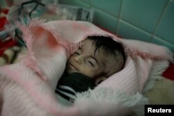 Hajar al-Faqeh, 4 months, who died at the malnutrition ward of al-Sabeen hospital, is seen at the hospital in Sanaa, Yemen, Nov. 15, 2018.
