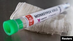 Tabung reaksi berlabel "Monkeypox virus positive" terlihat dalam ilustrasi ini yang diambil 22 Mei 2022. (Foto: REUTERS/Dado Ruvic)