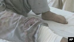 Trauma Expert: US Hospitals Not Equipped for Aftermath of Car Bombing